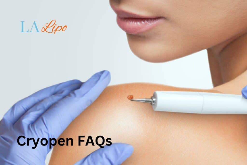 Cryopen FAQs