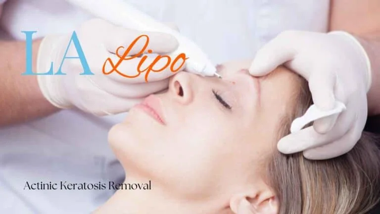 Woman receiving Actinic Keratosis Removal Treatment Cambridgeshire