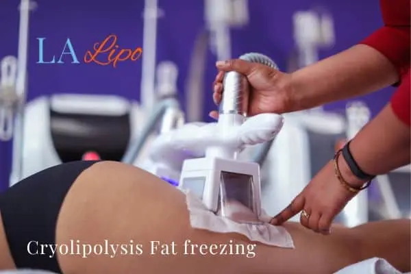 women getting fat freezing Cambridgeshire