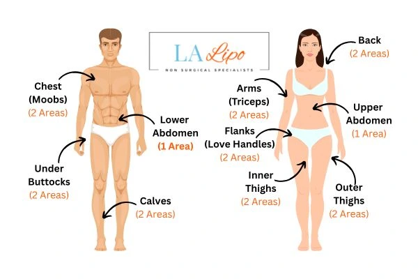 LA LIPO Cryolipolysis Areas Cambridgeshire