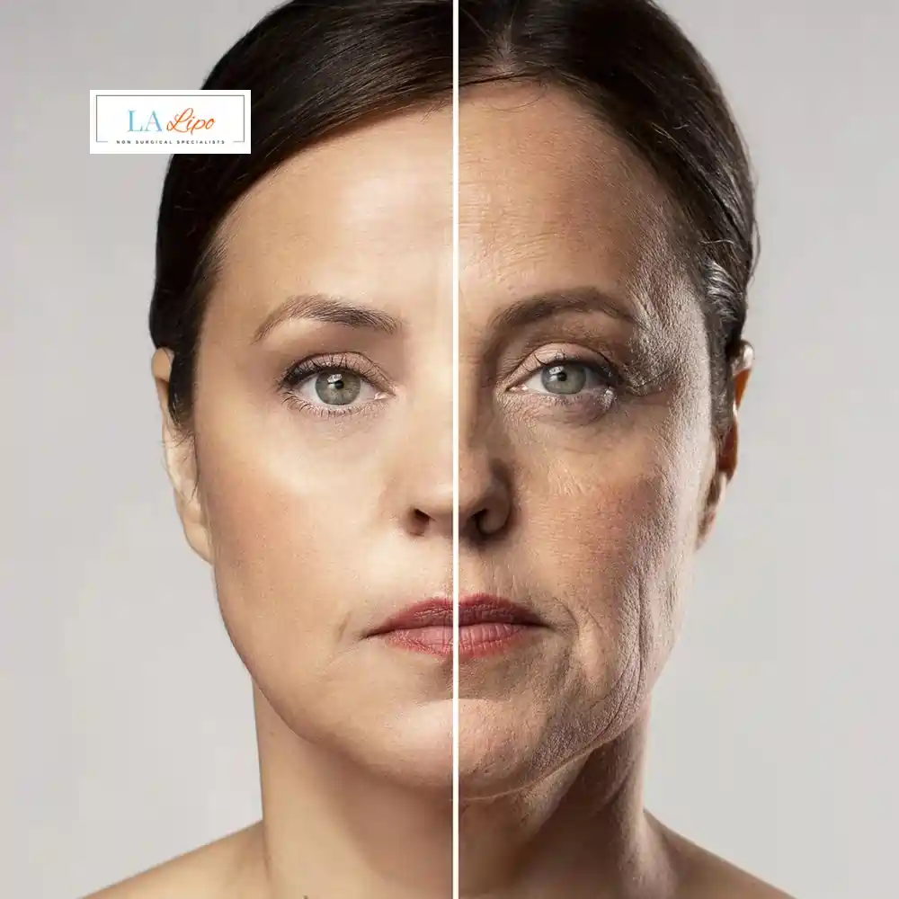 How Can You Tell If Non-Surgical Skin Tightening Is Right for You Cambridgeshire?