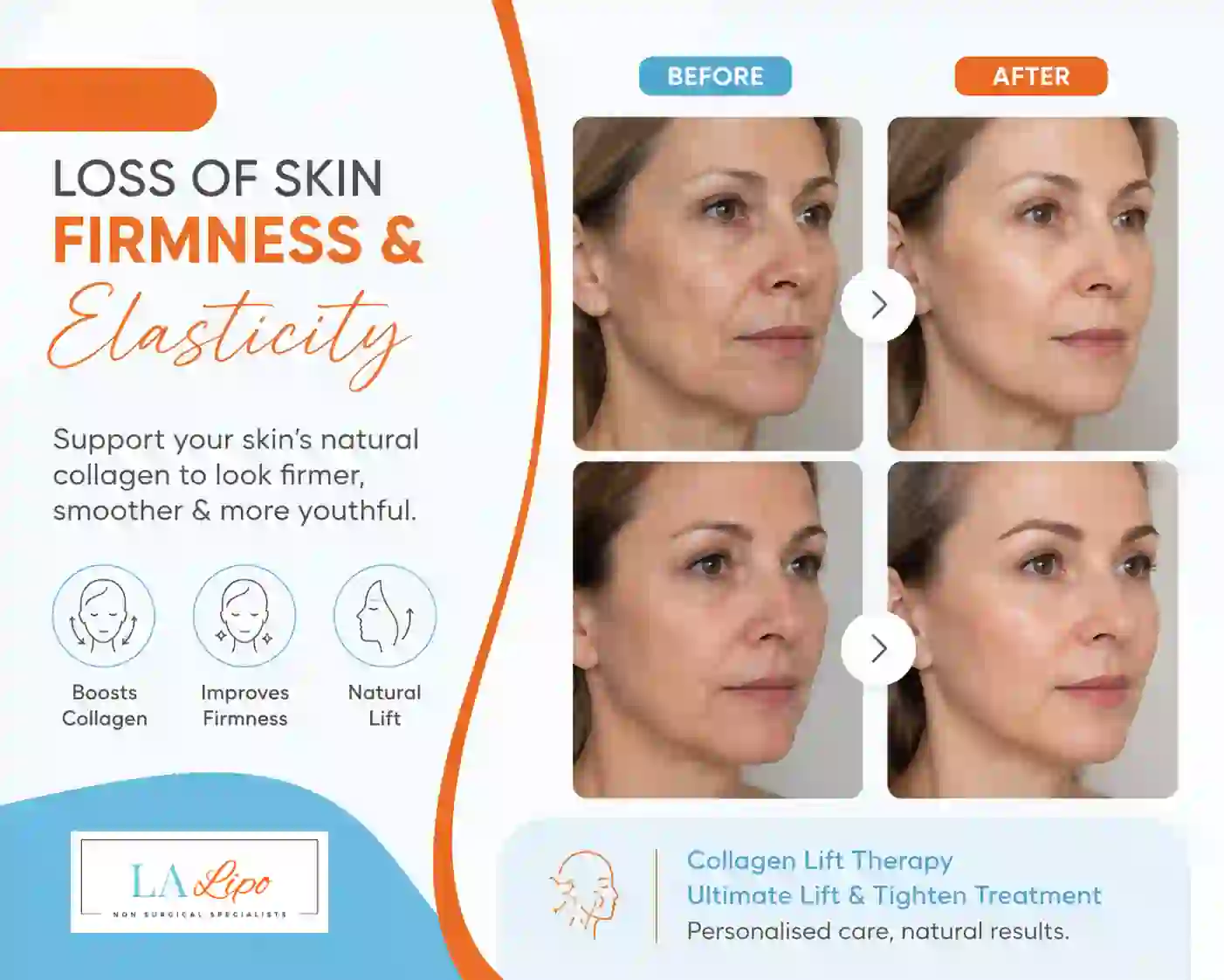 Sign #7: Loss of Skin Firmness and Elasticity Cambridgeshire