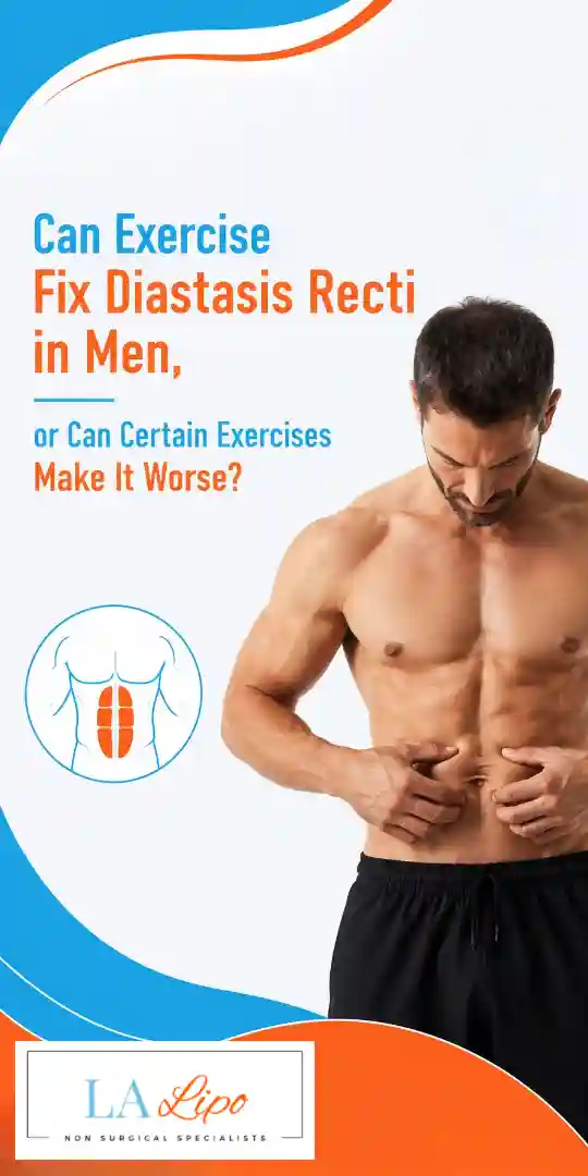 Can Exercise Fix Diastasis Recti in Men, or Can Certain Exercises Make It Worse Cambridgeshire?